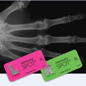 Radiographic Lead Markers